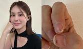 젤네일 오래 하면 이렇게 됩니다...가수 아이비가 공개한 충격적인 '손톱' 상태
