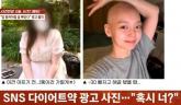'항암제로 19kg 뺐다'... 암환자 사진까지 도용해 '항암 다이어트' 홍보한 업체