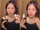'모모랜드' 출신 데이지, 아이돌 업계 '불편한 진실' 폭로... '부상 휴식기에 대부분 성형한다'