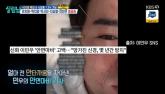 이민우, 얼굴 마비 증상 악화... 심각한 상태 알렸다