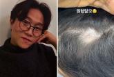 암투병으로 삭발한 아내 이솔이에 이어... 남편 박성광도 안타까운 소식 전했다